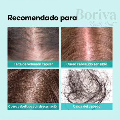 Serum Capilar PDRN con Cepillo de Aguja